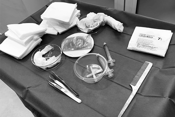 punch-line-hybride-paris-greffe-de-cheveux-fue-avant-apres-implant-capillaire-paris-chirurgien-plasticien-paris-dr-montoneri