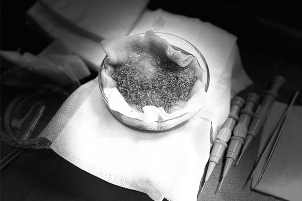 punch-line-hybride-paris-greffe-de-cheveux-fue-implant-capillaire-paris-chirurgien-plasticien-paris-docteur-montoneri